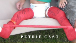 Petrie Cast?