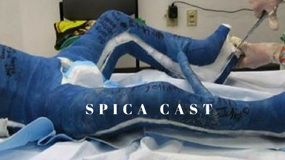 Spica Casting 101